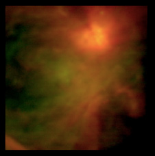 Sternentstehungskomplex Orion