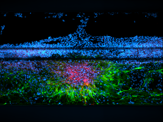 fluorescence microscopy image of astrocyte