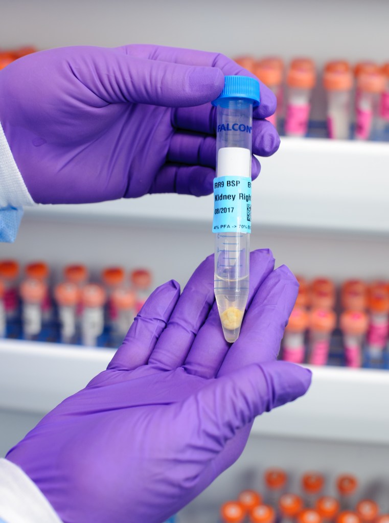 Biospecimens in NBISC