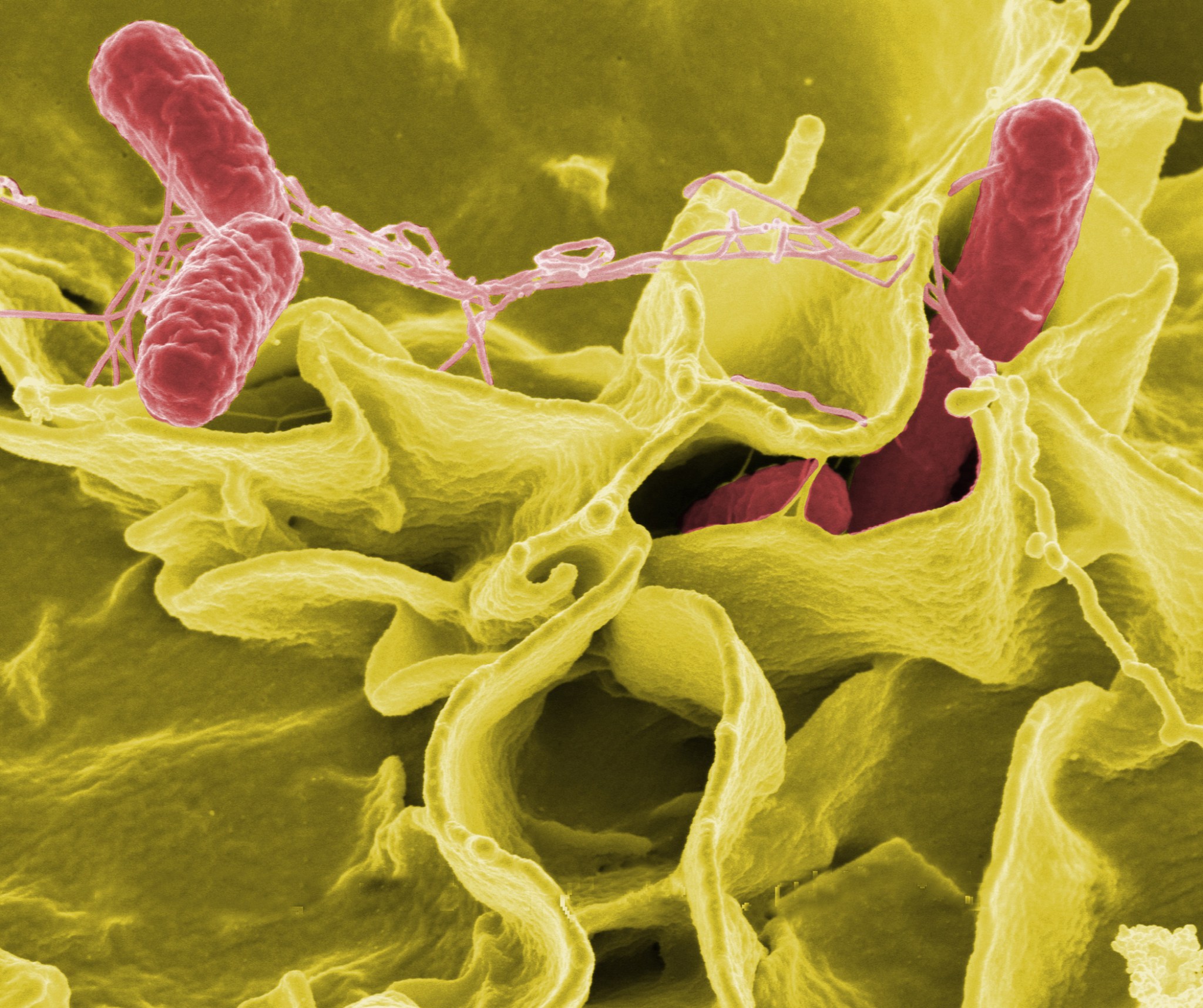 An example of Salmonella invading cultured human cells. (Rocky Mountain Laboratories.