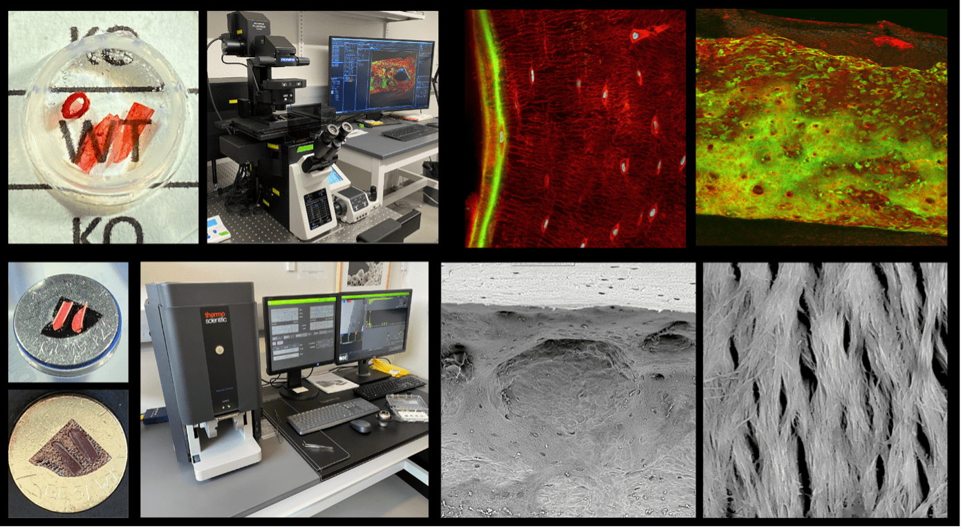 collage of electron microscope images