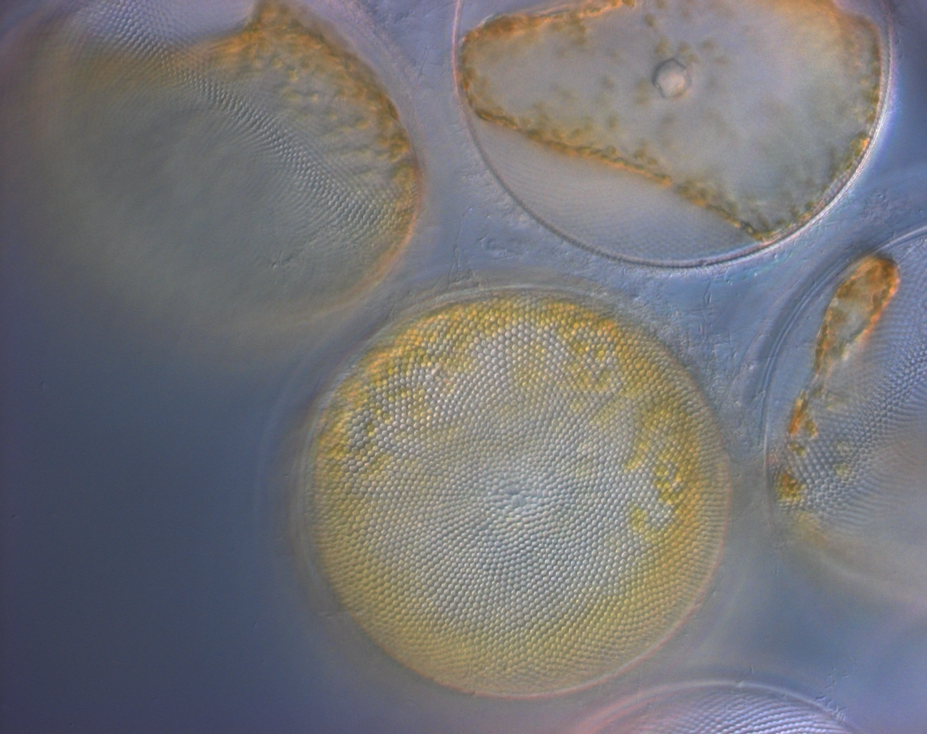 microscope view of phytoplankton