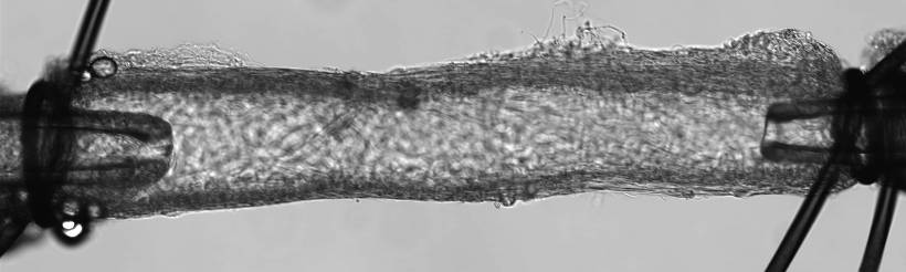 A cervical lymph vessel of a mouse that will be studied post flight
