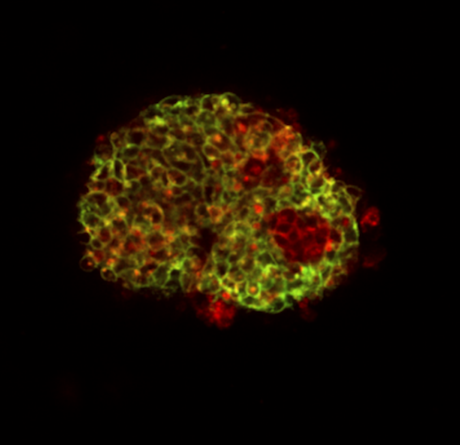 Mouse induced pluripotent stem cell aggregate labeled with fluorescent markers for a transcription factor expressed during stem 