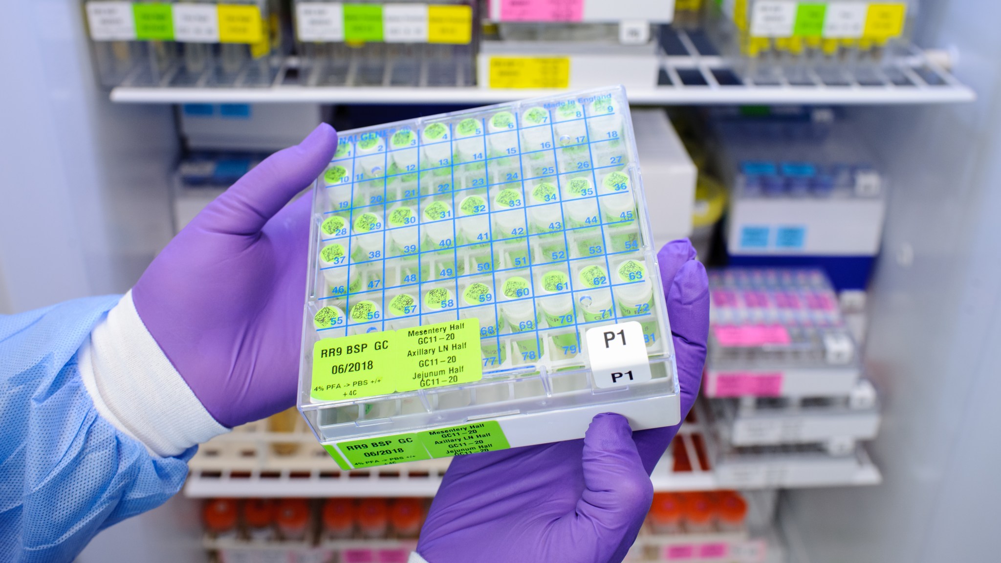 A box containing samples of preserved tissues are held by a researcher. 