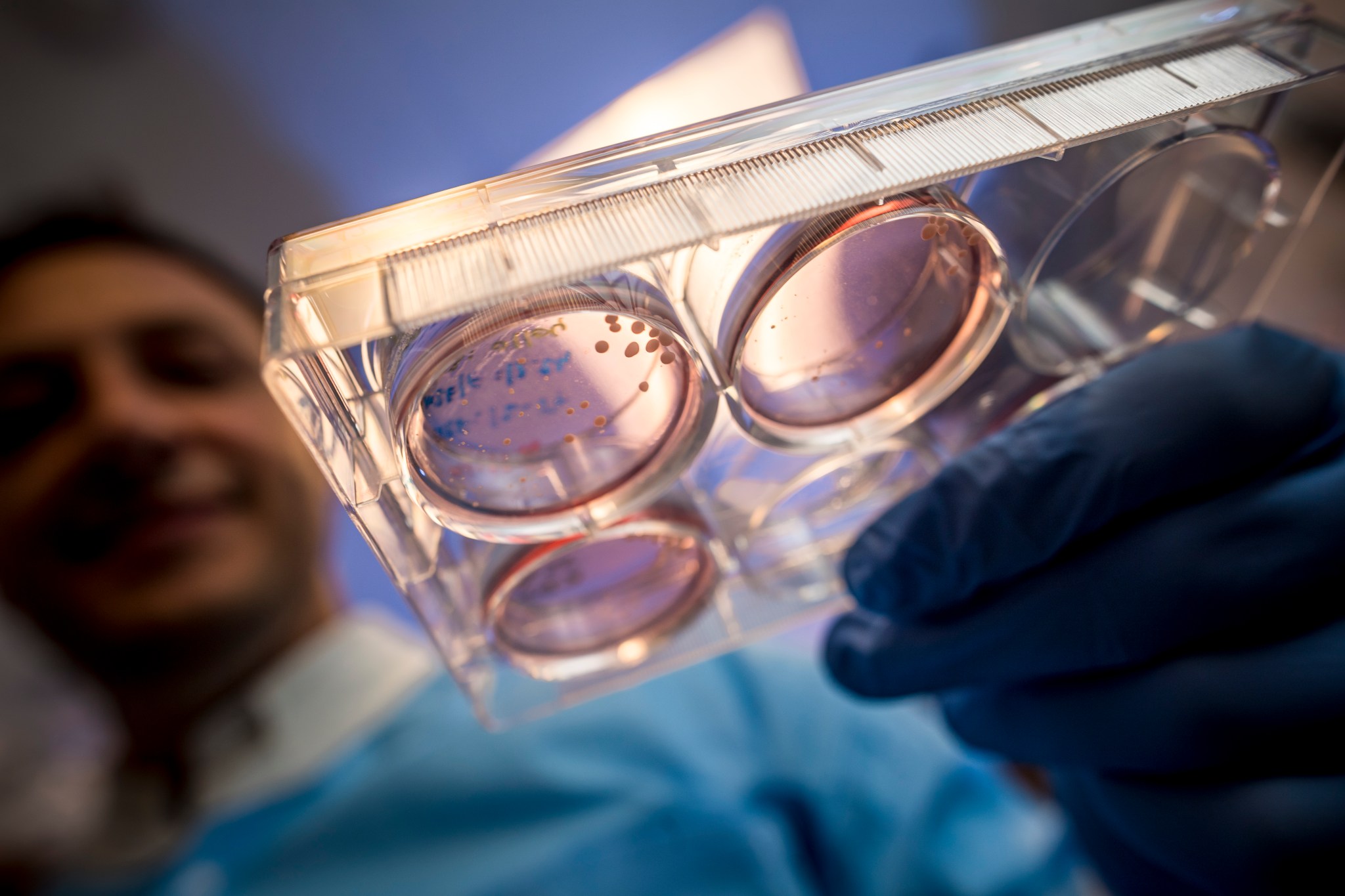 Brain organoids inside sample container