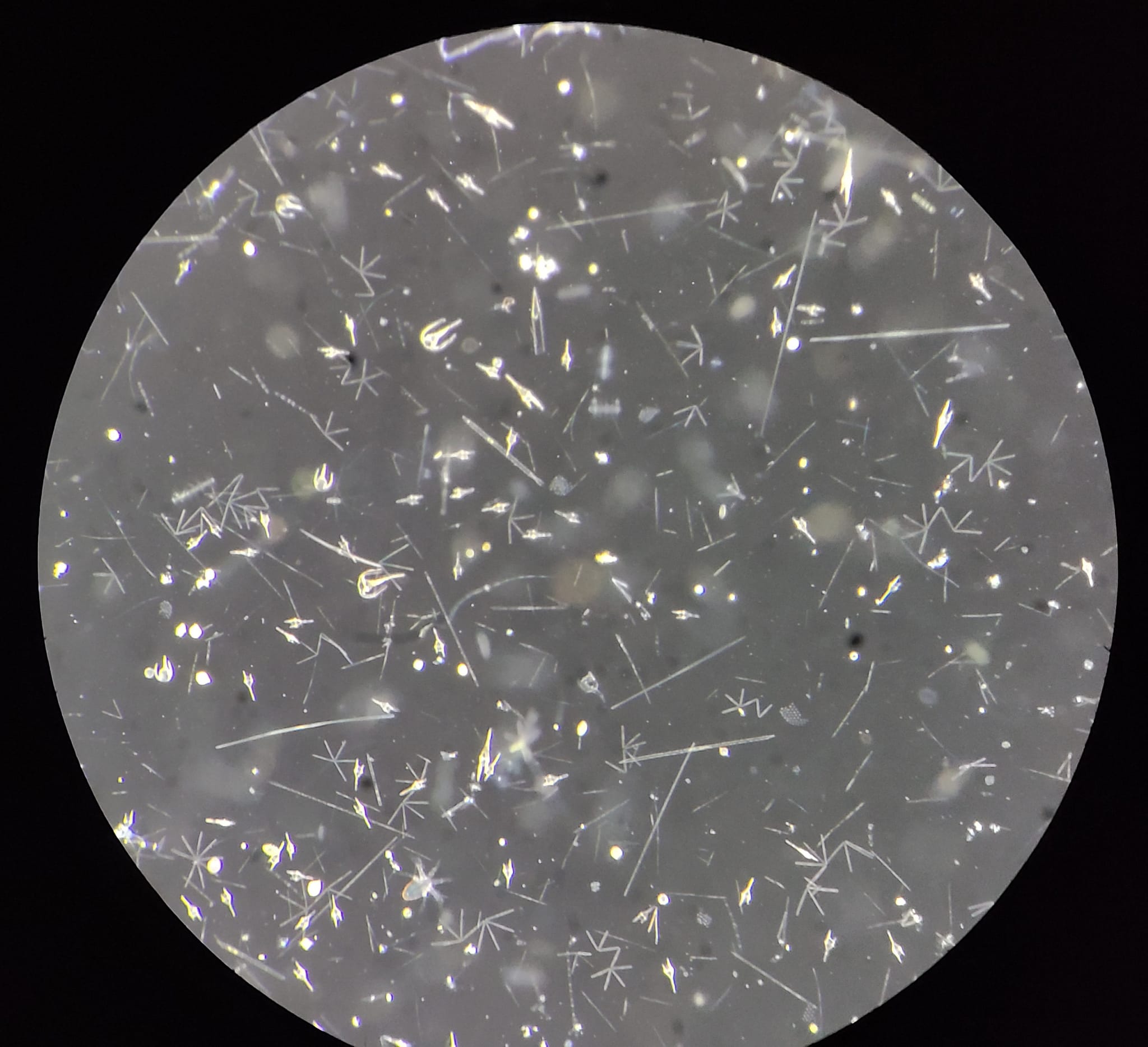 A circular dish filled with a variety of phytoplankton, which show up as bright white against the gray background.