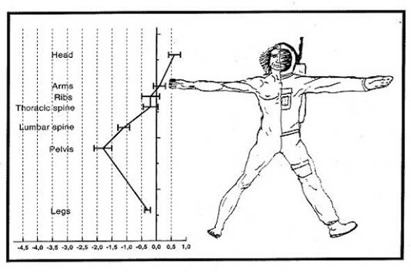 body diagram