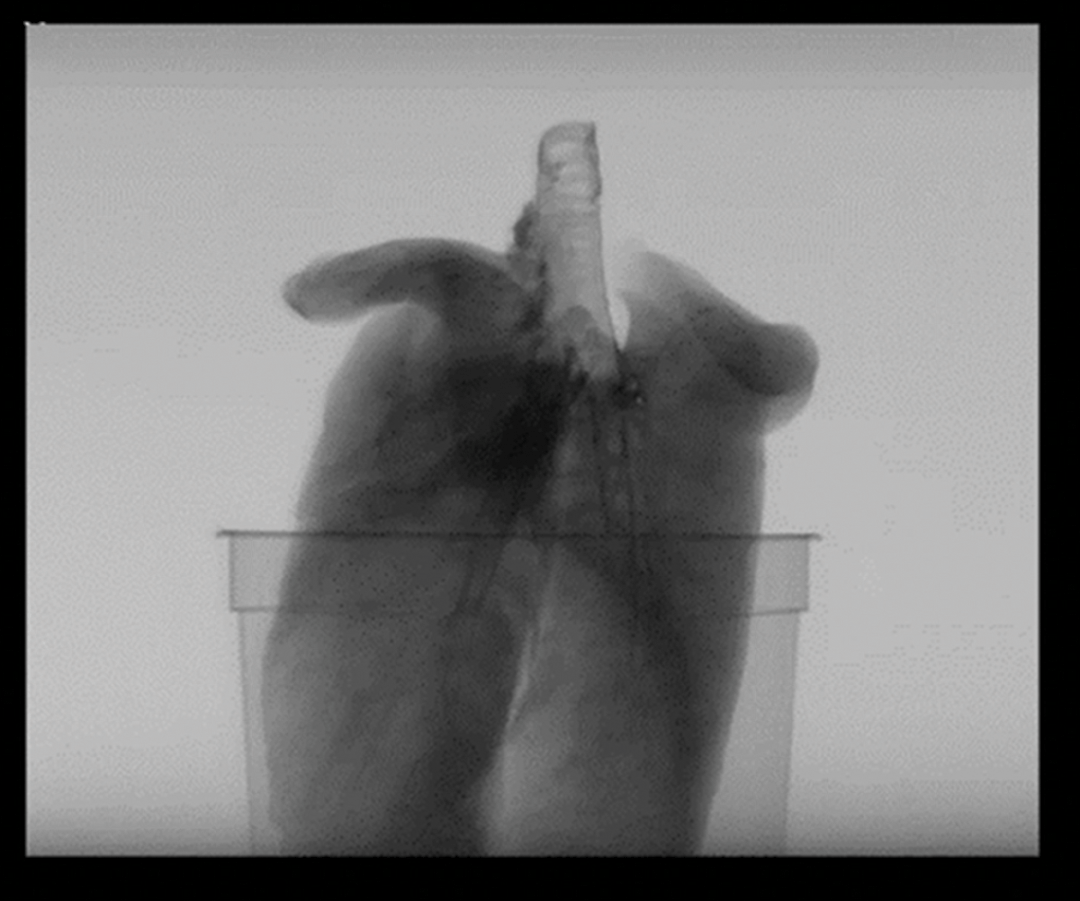 X-Ray image of a pig heart