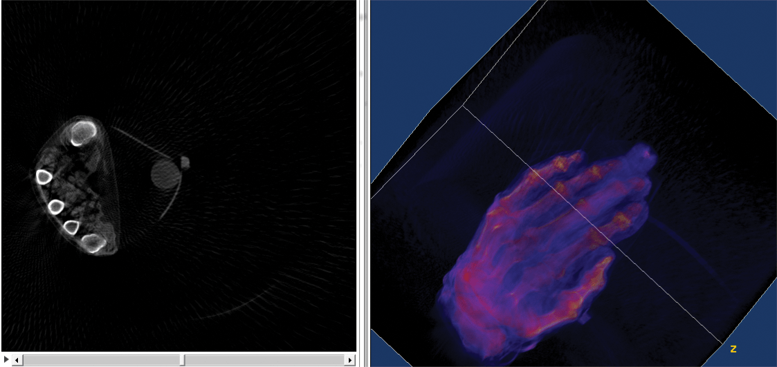 images of a scan of a human hand