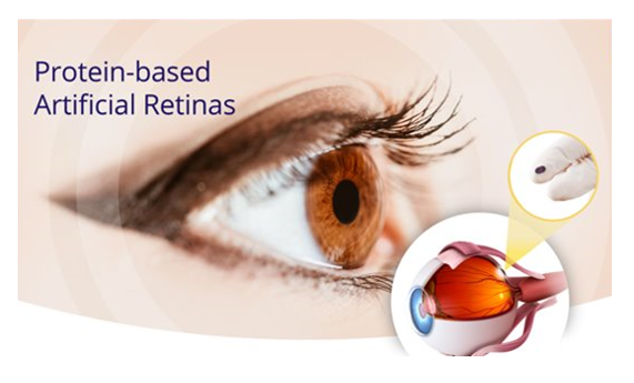 diagram of a human eye and an artificial retina