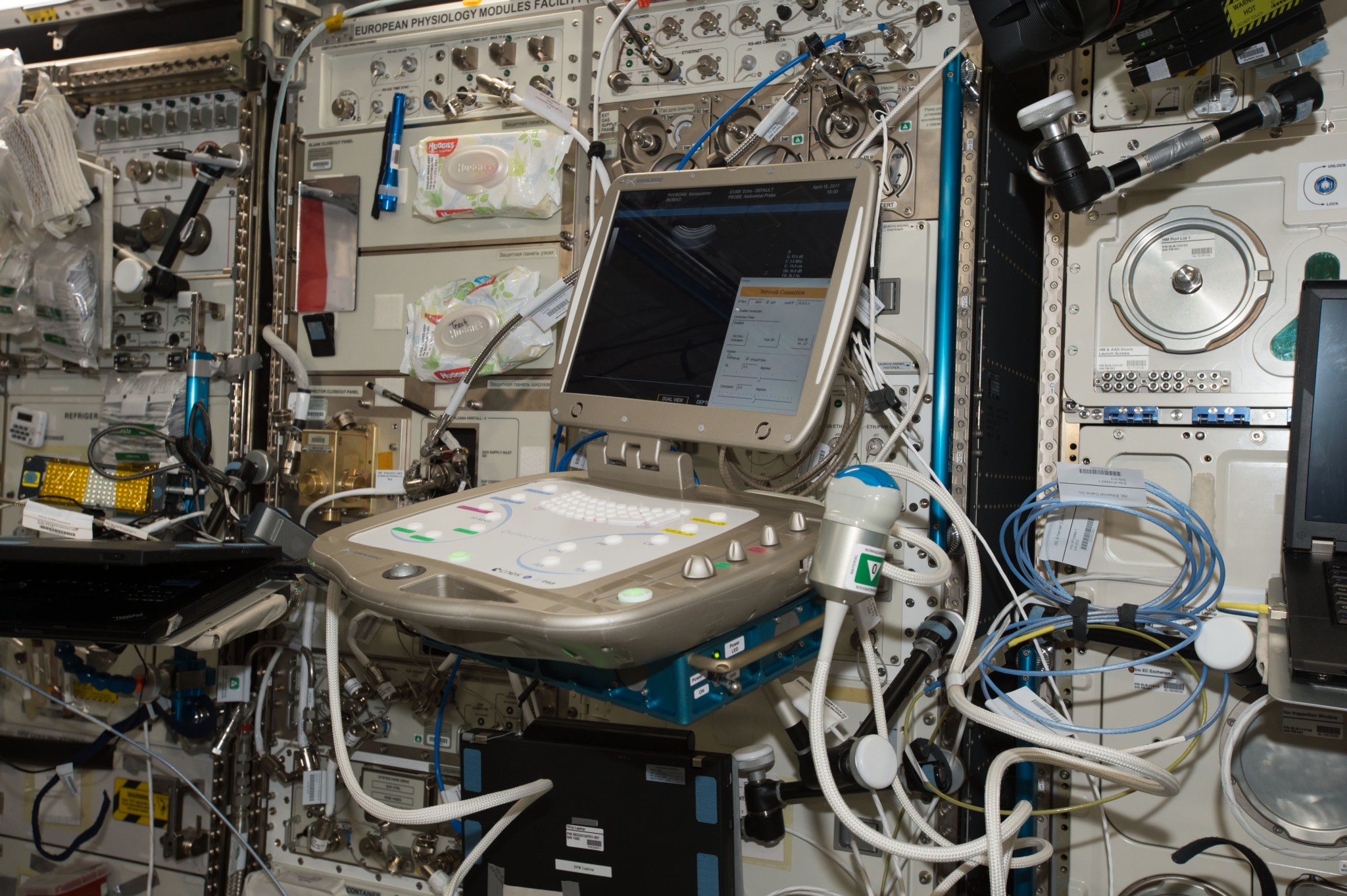 image of an ultrasound machine inside the space station