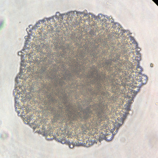 A heart cell culture