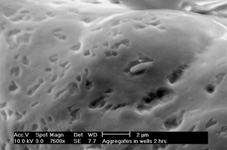 Environmental Scanning Electron Microscopy (ESEM) image of Salmonella enterica Typhimurium invading intestinal cell aggregates