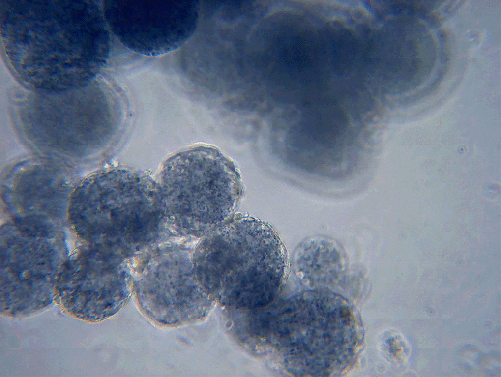 Space Biology Touches Our Hearts