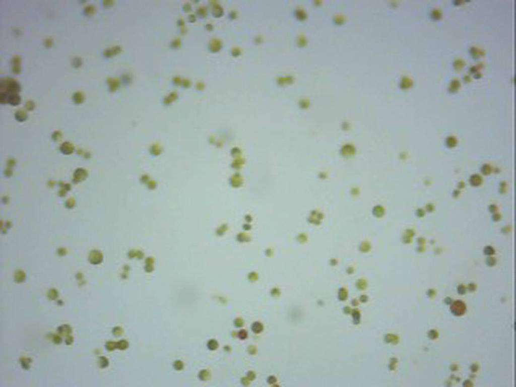 Slide of Algae From The University of Texas