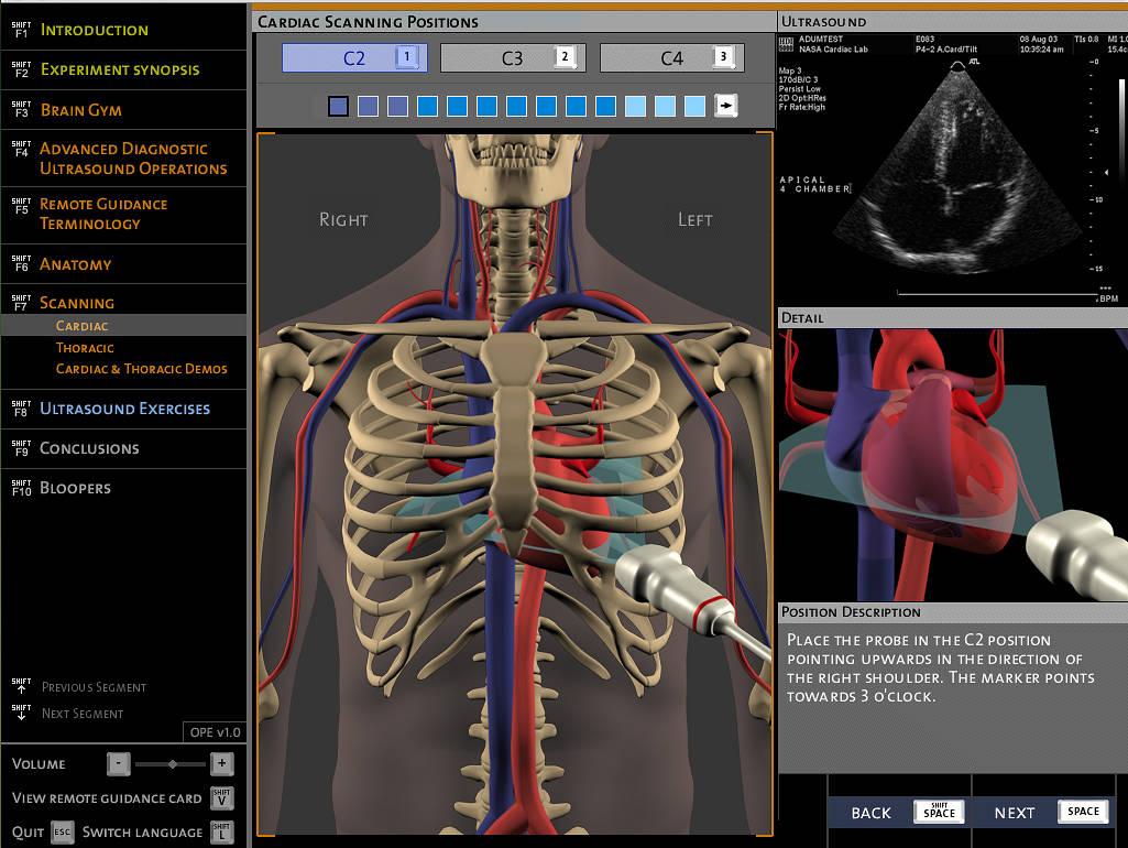 Screen from Ultrasound Catalog