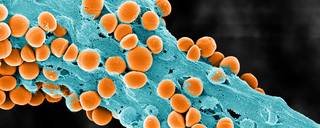 This scanning electron microscopic image shows a biofilm, colored to show cells of Staphylococcus capitis (round orange knobs) embedded in the biofilm matrix (larger blue rod-shaped figure).
