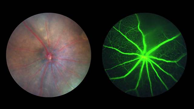 Taken with a specialized camera, images of a mouse retina before spaceflight (left) and a fluorescein angiogram, captured using a fluorescent dye, of the microvascular circulation of a mouse retina (right) are shown here.