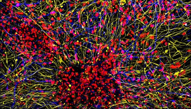 This image shows projections of neurons (yellow) and astrocytes (blue) from human brain organoids, with cell nuclei marked in red.