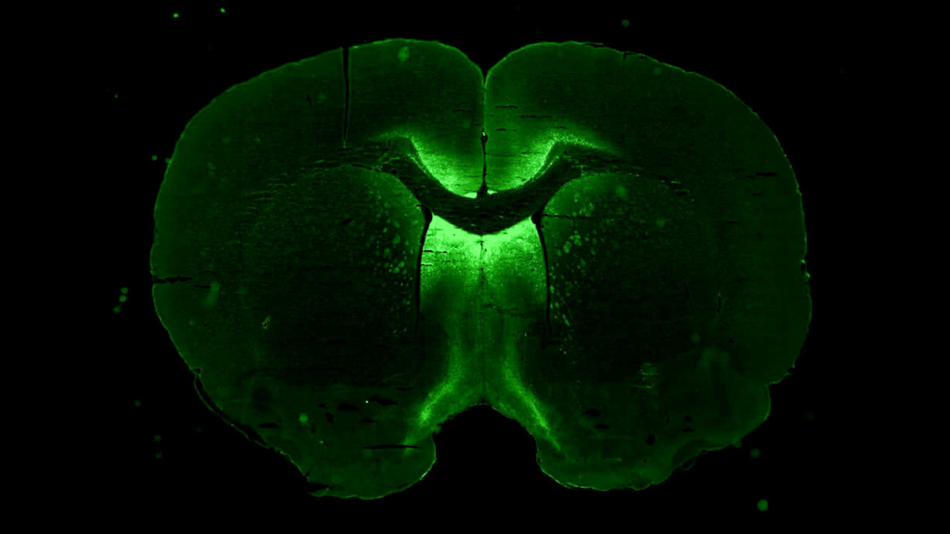 Houston We Have A Podcast Episode 291: Improving Precision Neuroscience. A preflight vector image of AAV gene therapy that selectively targets neurons to induce axon regeneration.