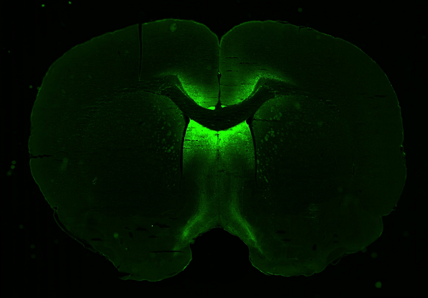 3Dl neuronal cells cultured in microgravity for Neuronix, which tests a gene therapy for neurological diseases.