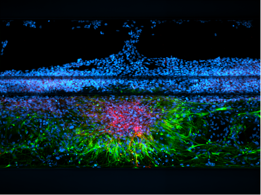 An image of Astrocytic scar in a human neurovascular model.