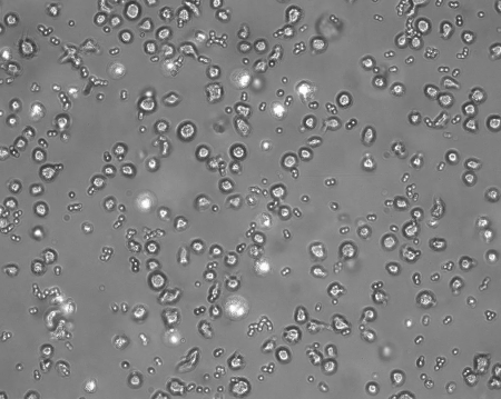 microscopic image of human monocytes engulfing yeast cells