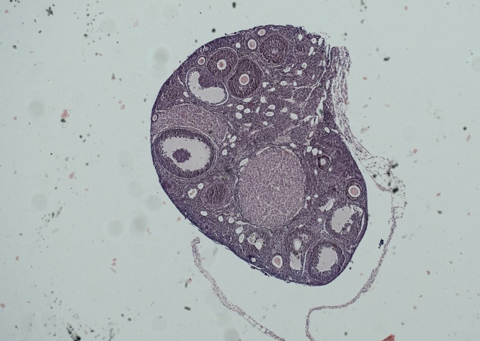 Image of a section of ovarian tissue