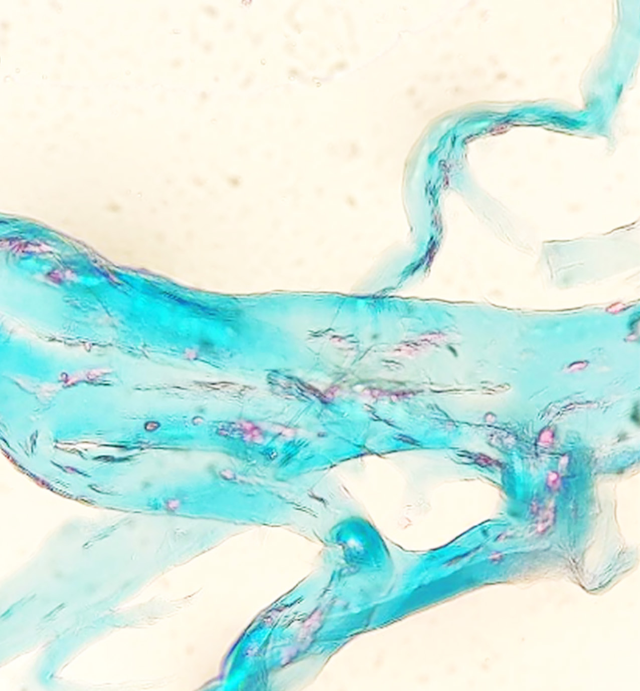 A section of tissue stained a bluish-green stretches across this image. Scattered throughout the tissue are small clumps of cells stained a pinkish-red.
