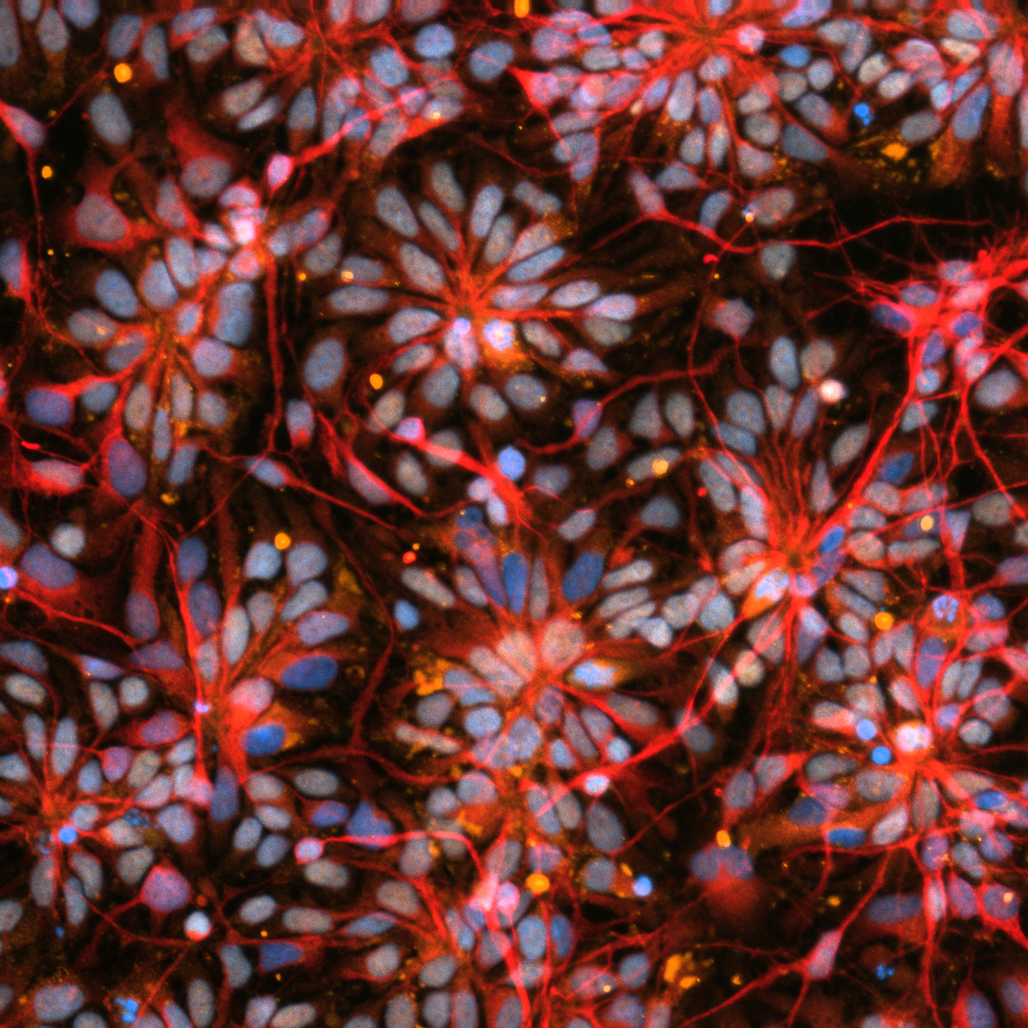 The image is covered by flower-like clusters of pale white and blue cells connected by reddish nerves.