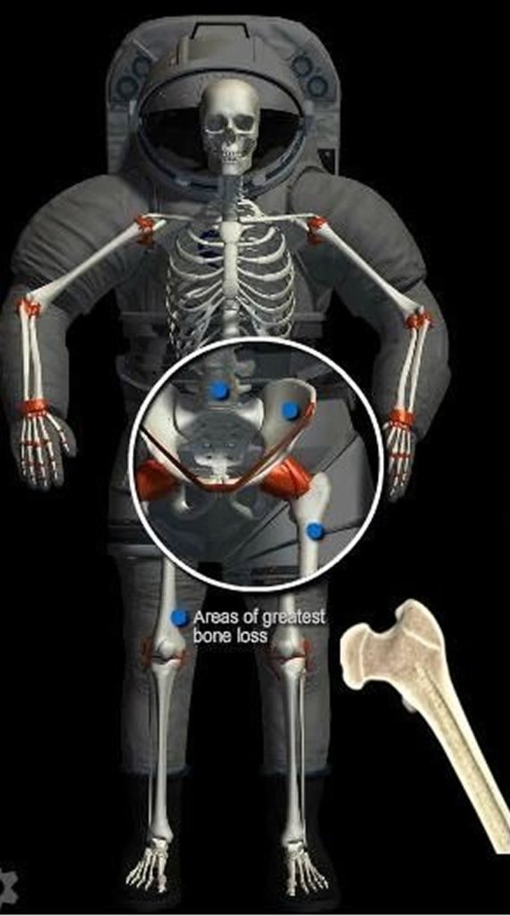 Thinning bones on astronauts