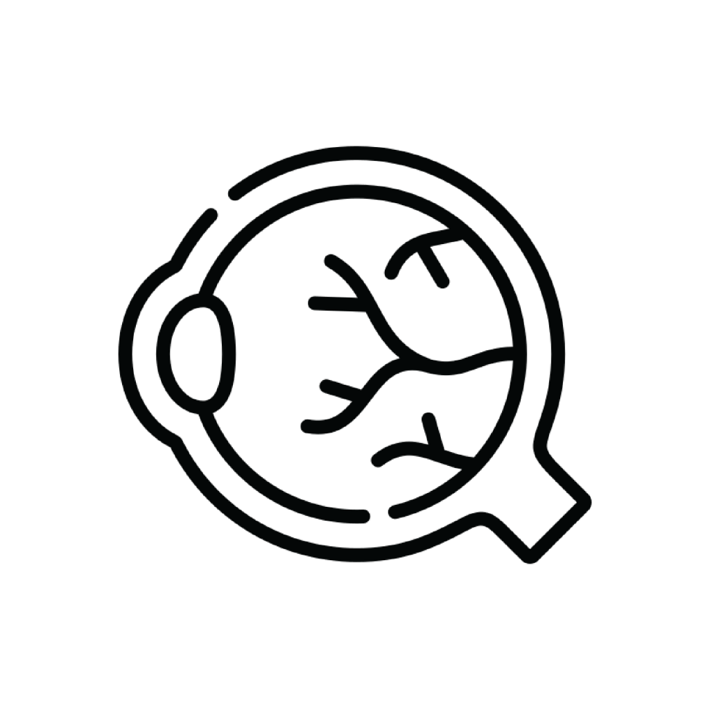 Medial clip art diagram of an eye.