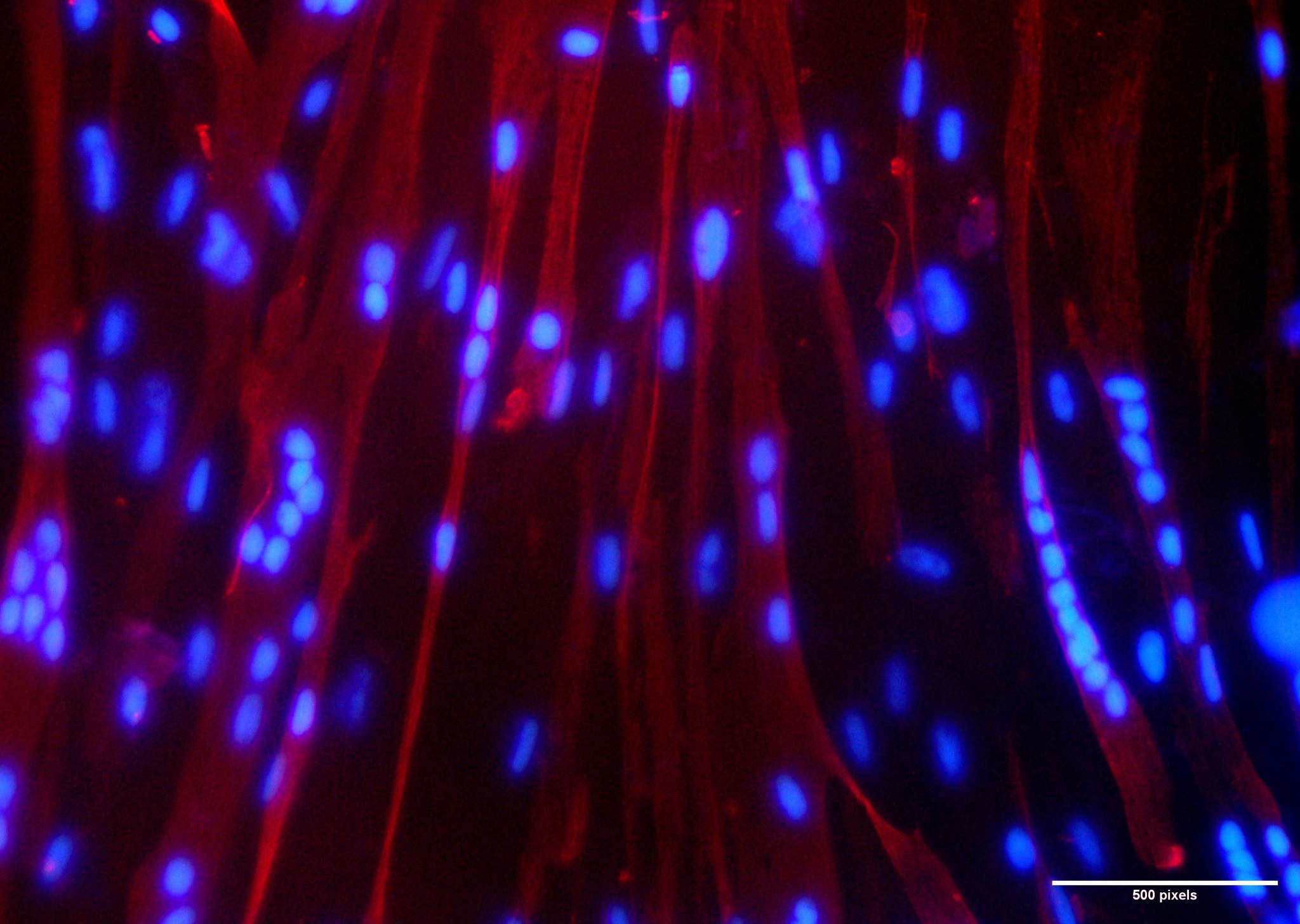 Dark red fibers stretch from the top to bottom of this image. Glowing blue dots are scattered along the fibers, both single dots and lines and clusters of dots.