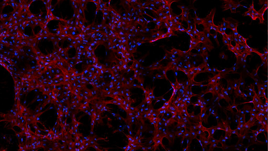Stem cells grown on nanomaterial scaffolds aboard the International Space Station showed that structural improvements were obtained through in-space manufacturing and translated directly into biological improvements. The space-grown stem cells could help advance regenerative medicine research for vaccines and cartilage repair. Image courtesy of the University of Connecticut.