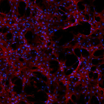 Stem cells grown on nanomaterial scaffolds aboard the International Space Station showed that structural improvements were obtained through in-space manufacturing and translated directly into biological improvements. The space-grown stem cells could help advance regenerative medicine research for vaccines and cartilage repair. Image courtesy of the University of Connecticut.