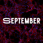 Stem cells grown on nanomaterial scaffolds aboard the International Space Station showed that structural improvements were obtained through in-space manufacturing and translated directly into biological improvements. The space-grown stem cells could help advance regenerative medicine research for vaccines and cartilage repair. Image courtesy of the University of Connecticut.