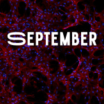 Stem cells grown on nanomaterial scaffolds aboard the International Space Station showed that structural improvements were obtained through in-space manufacturing and translated directly into biological improvements. The space-grown stem cells could help advance regenerative medicine research for vaccines and cartilage repair. Image courtesy of the University of Connecticut.