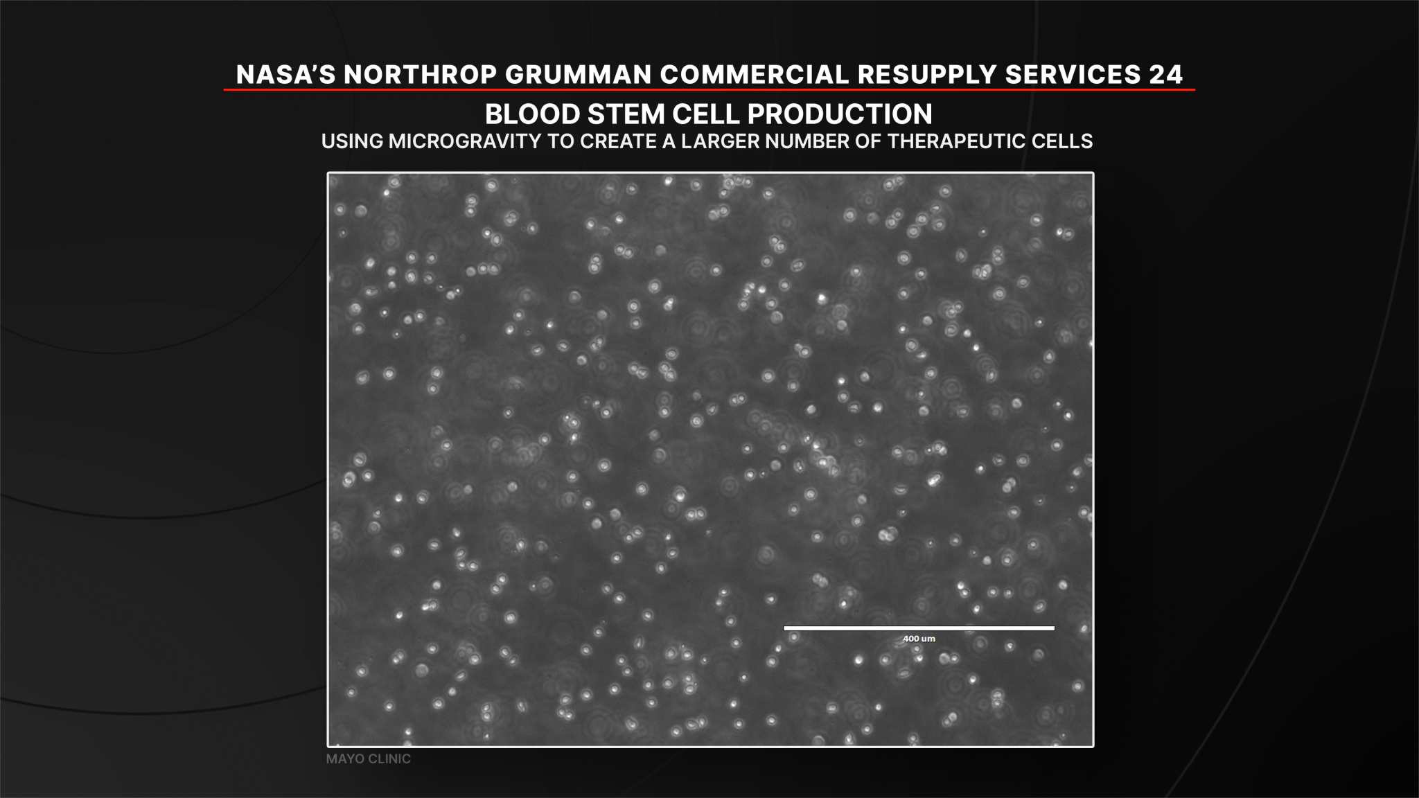 An investigation (InSPA-StemCellEX-H2) studying blood stem cell production in microgravity to create a larger number of therapeutic cells. Successful stem cell production could advance healthcare on Earth for patients with certain blood diseases and cancers.