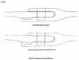 Figure 24. Pressurized Joint Deflection.